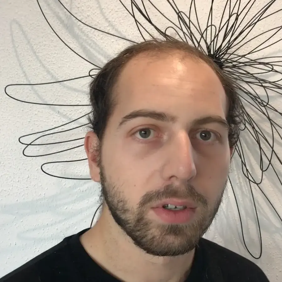 Un client avant : front dégarni, cheveux clairsemés sur le dessus